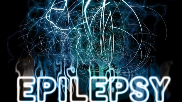 facts-about-epilepsy-seizures