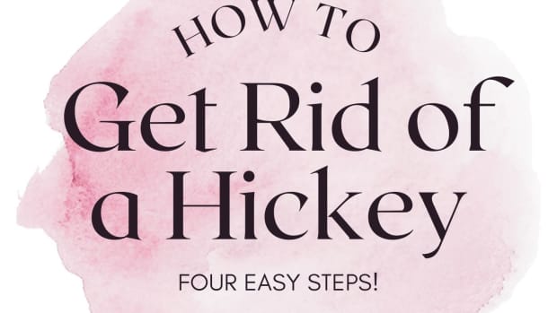 how-to-get-rid-of-a-hickey-now