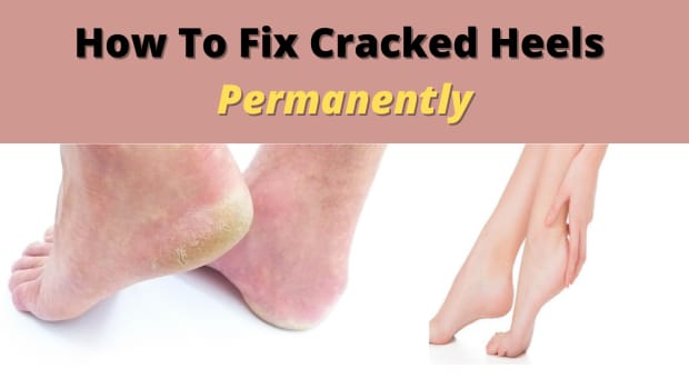 the-ultimate-guide-to-fix-cracked-heels-permanently-and-get-soft-feet-at-home