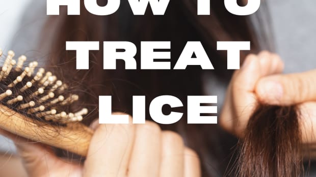 how-to-completely-get-rid-of-head-lice
