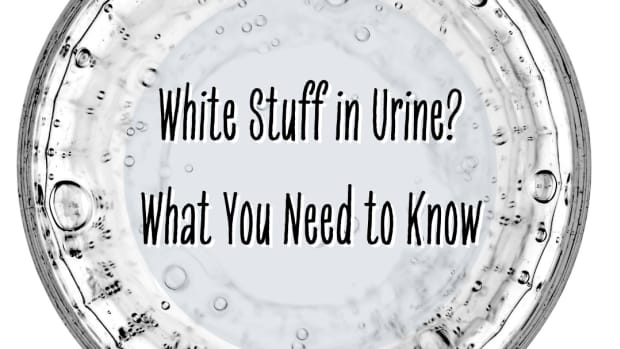 white-stuff-in-urine