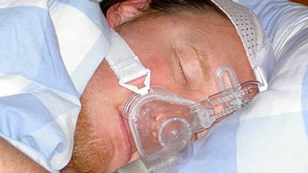 are-you-at-risk-for-sleep-apnea