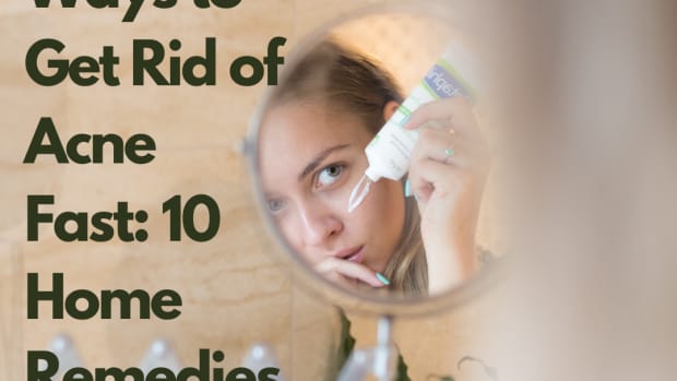 how-to-get-rid-of-acne-overnight-best-ways-to-get-rid-of-acne-fast
