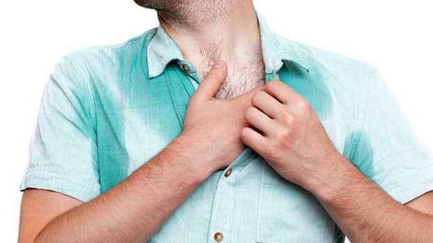 8-causes-of-excessive-sweating-you-should-know