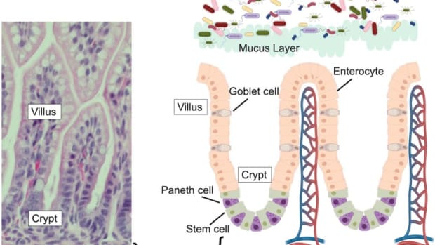 paneth-cells-in-intestinal-glands-and-inflammatory-bowel-disease
