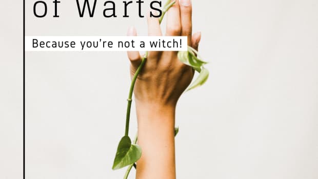 only-witches-want-warts