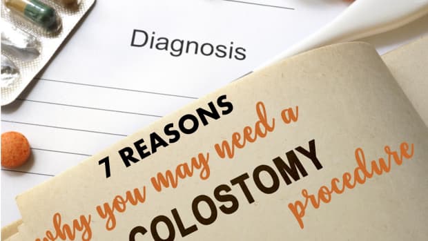 colostomy-stoma_7-reasons-why