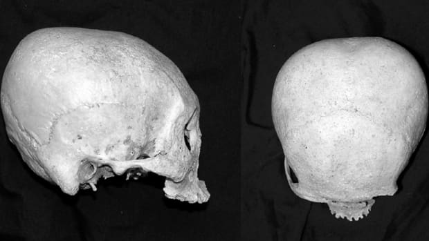 the-precolonial-visayan-practice-of-skull-deformation
