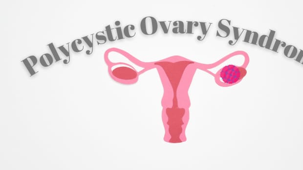 polycystic-ovary-syndrome-pcos-symptoms-causes-and-treatment