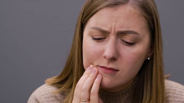 soft-teeth-syndrome-causes-symptoms-prevention