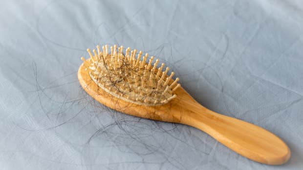 A dirty wooden hairbrush with fall-out hair, it's a sign of a hair loss problem