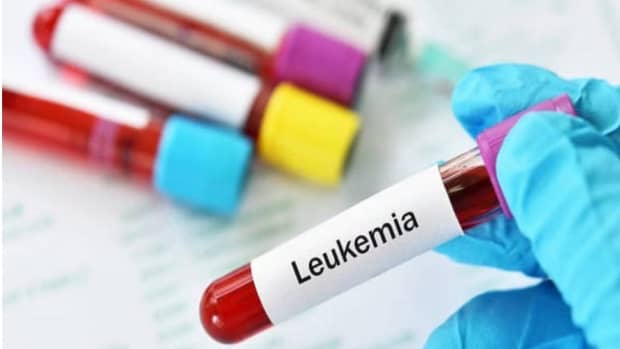fighting-leukemia-what-you-need-to-know-about-this-blood-cancer