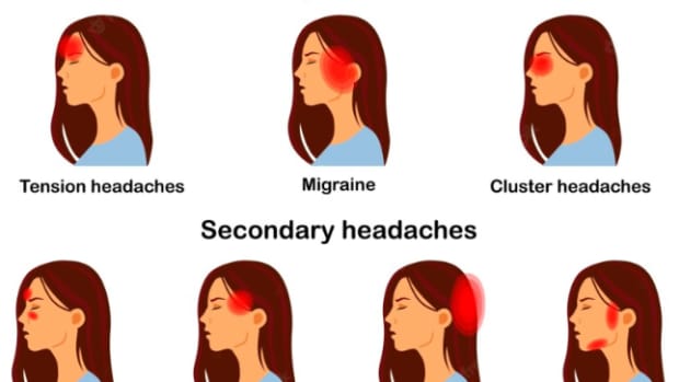 top-tips-for-migraine-relief