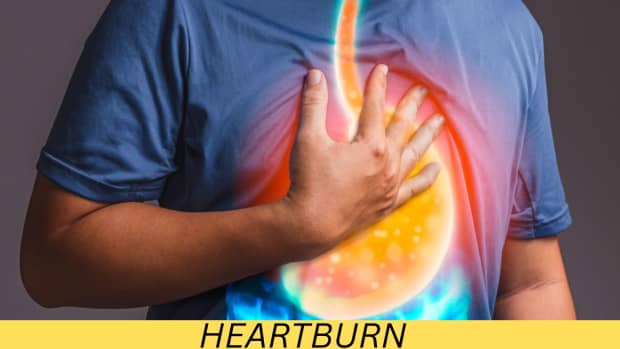 natural-home-remedies-for-heartburn-relief-20-tips-and-tricks-for-soothing-indigestion