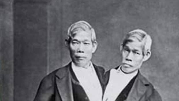 two-siamese-brothers-21-children-one-incredible-true-story-the-bunkers-unbelievable-tale
