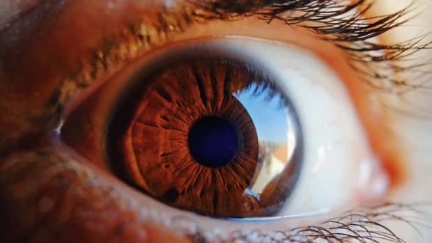retina-tear