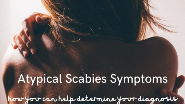 scabies-can-cause-itching-and-crawling-sensations-on-your-skin