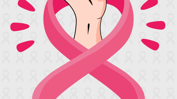 the-ulitmate-guide-to-breast-cancer-treatment-is-it-possible-to-cure-breast-cancer
