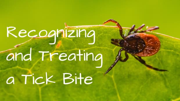 tick-bite-pictures-symptoms-causes-treatment