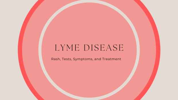 lyme-disease-rash-pictures-test-symptoms-causes-treatment