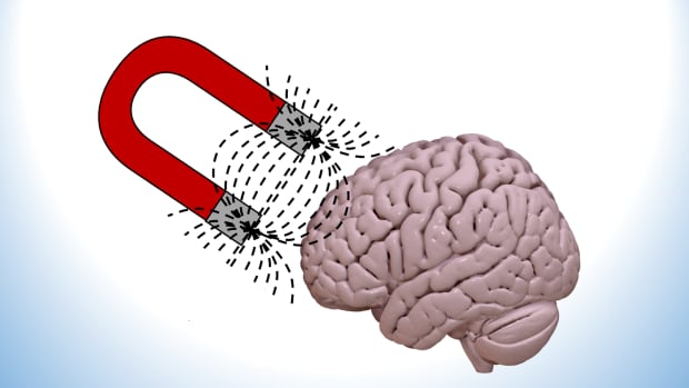 magnets-in-the-fights-against-brain-disorders