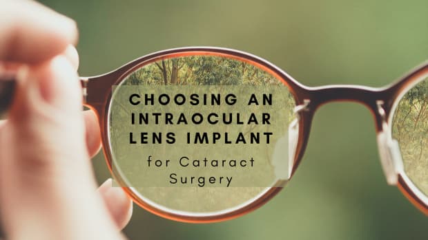 choosing-an-intraocular-lens-implant-for-cataract-surgery
