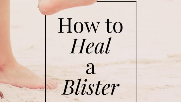 blister-treatment-causes-and-care