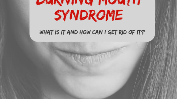 how-i-curbed-my-burning-mouth-syndrome