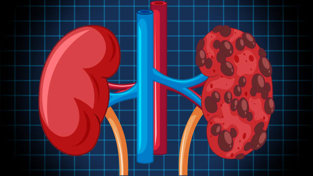 how-do-you-know-your-kidneys-are-healthy