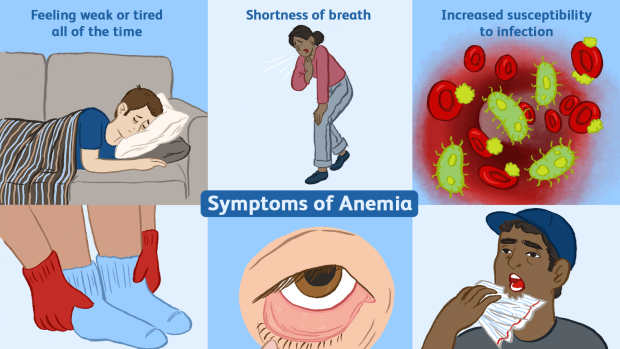 anemia-causes-and-how-you-can-avoid-it