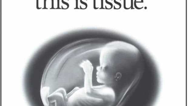 the-legalization-of-abortion-violates-the-right-to-life-of-unborn-children