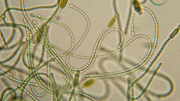 what-are-cyanobacteria-and-how-are-they-similar-or-different-from-true-plants