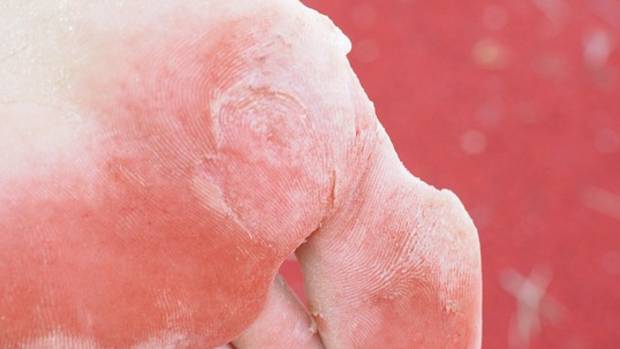 Foot Care - RemedyGrove - Holistic Wellness