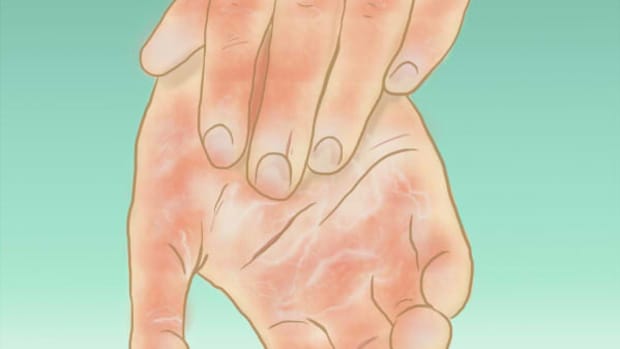 bad circulation to feet bad circulation to feet