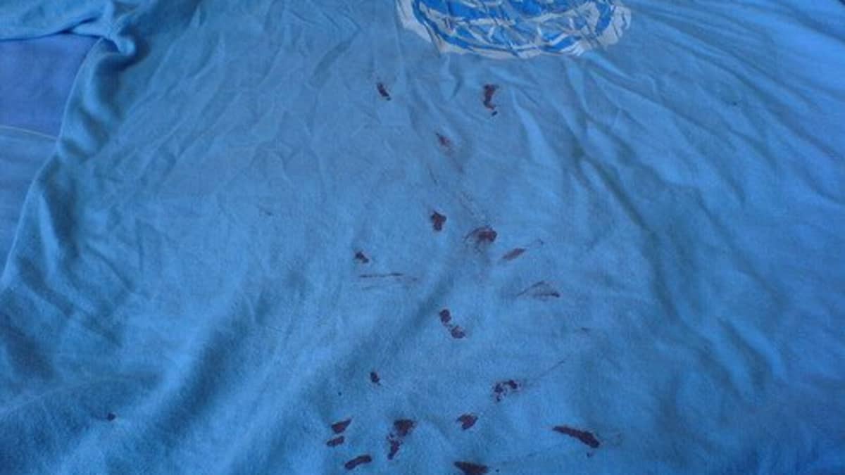 How to Remove Blood Stains From Clothes - Dengarden
