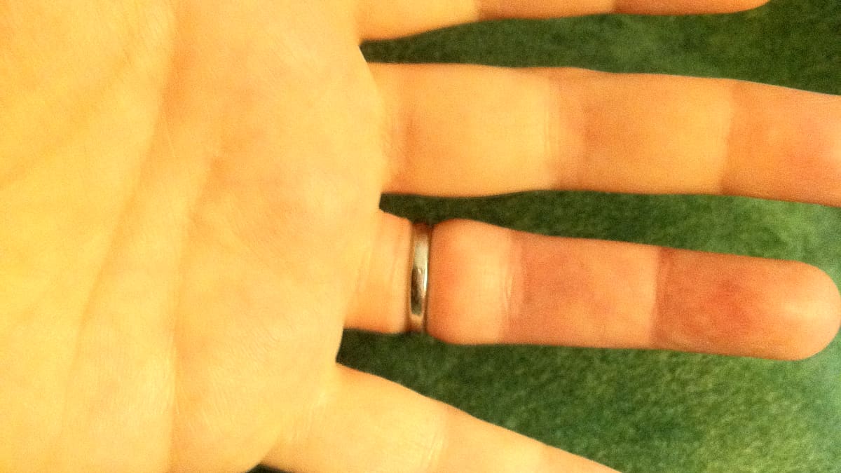 Removing ring stuck on finger for 15 years, finger, ring