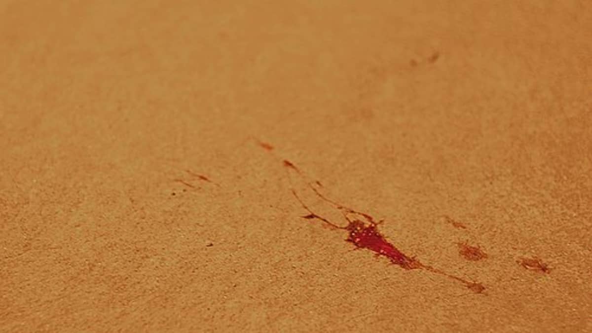 Blood Stain Hacks Debunked- Do Home Remedies for Blood Stains