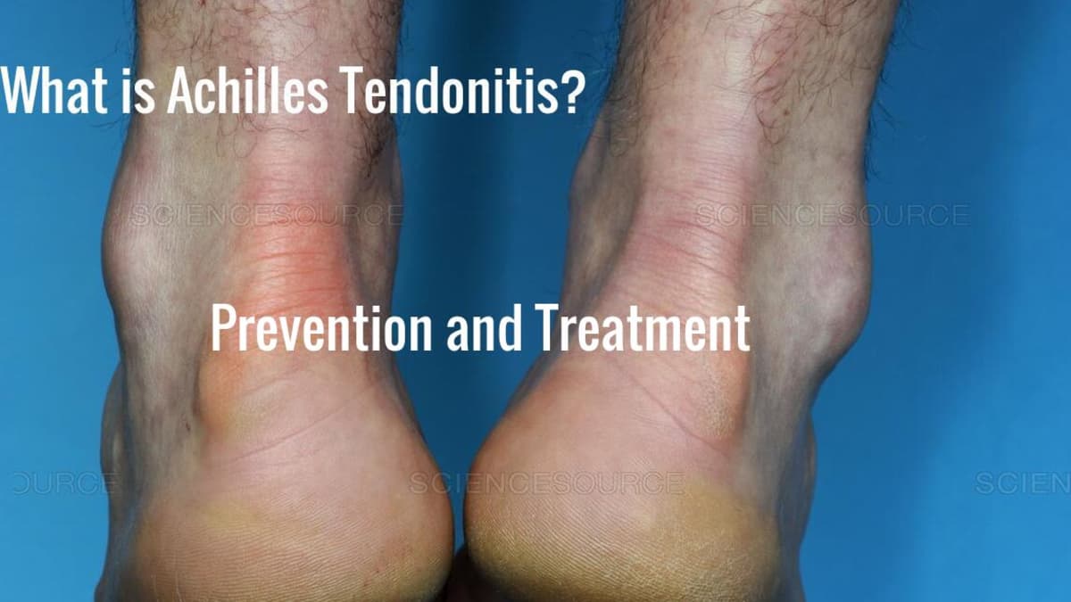 Achilles Tendon Injury In Dogs, Symptoms And Treatments - Stem Cell Safari