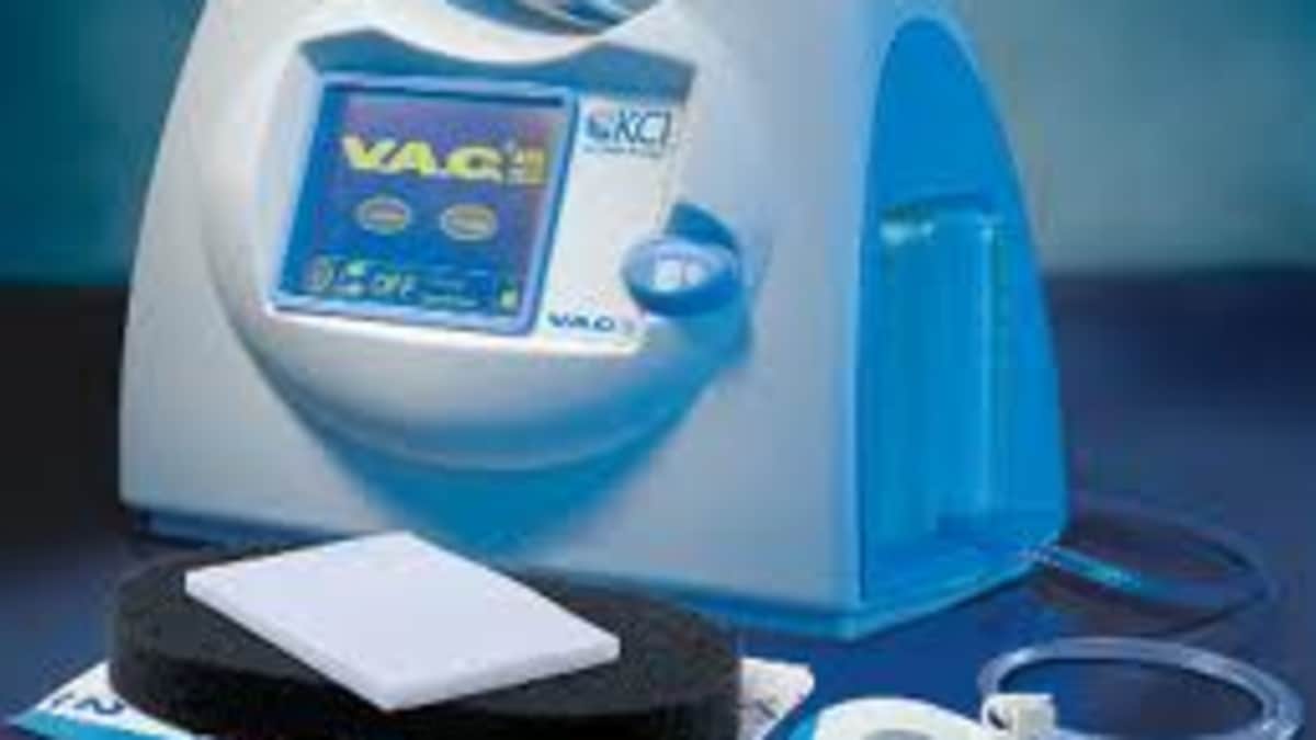 Wound Vac Therapy Information, Pictures and Cost - HubPages