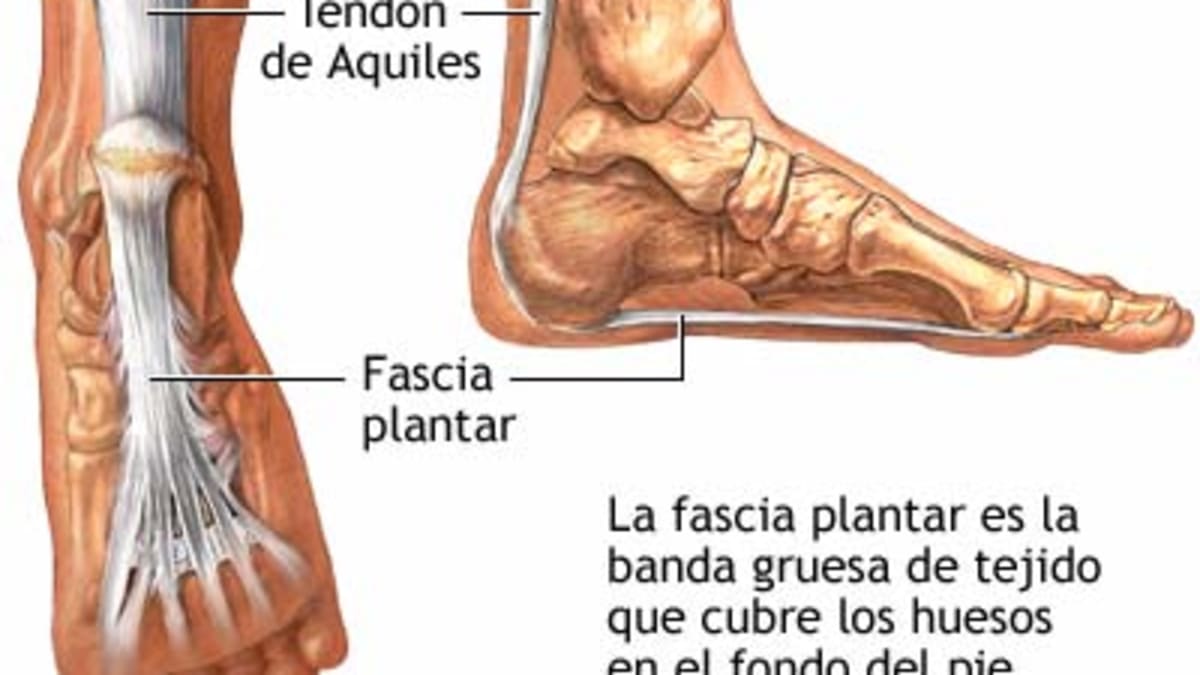 cure plantar fasciitis in 5 minutes