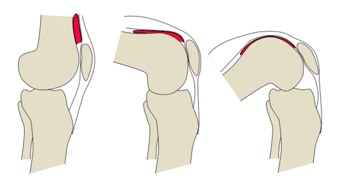 Anatomy of the Knee Joint (With Diagrams and X-Ray) - Owlcation