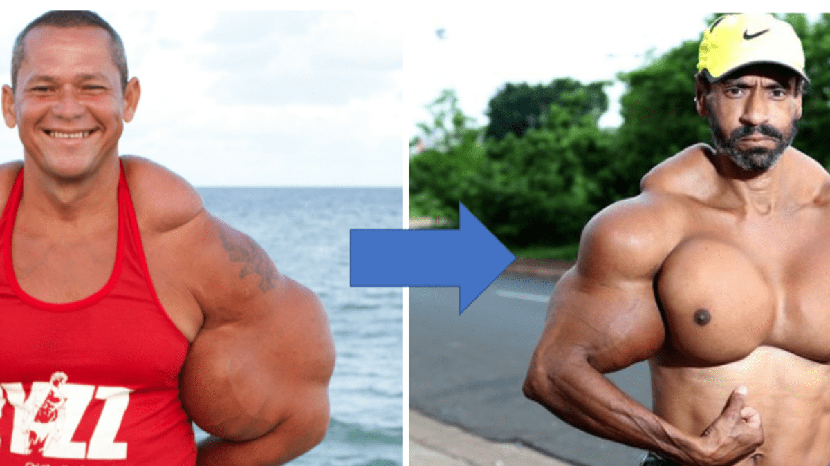 7 Freakish Bodybuilders Who Bulked-Up the Wrong Way - HubPages