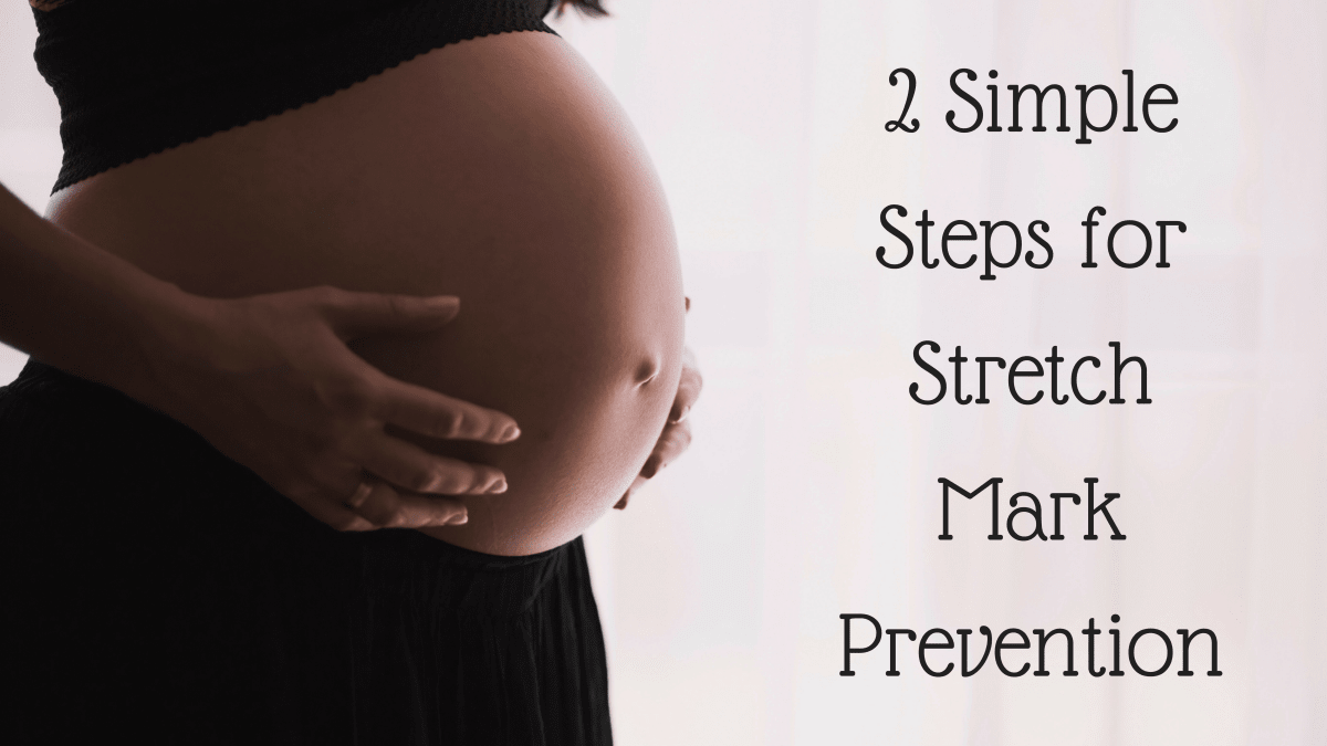 best lotion to prevent stretch marks while pregnant