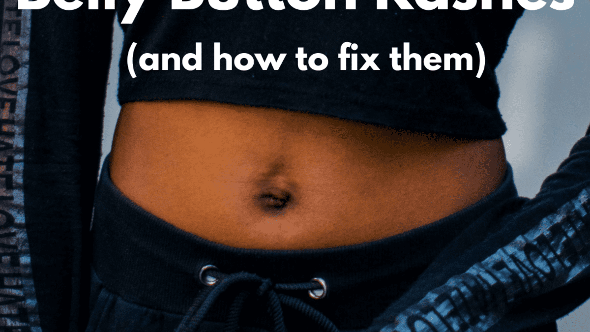 what causes drainage from belly button