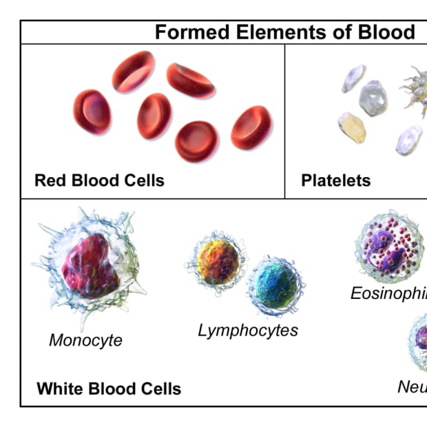 thrombocytopenia-platelets-and-bleeding