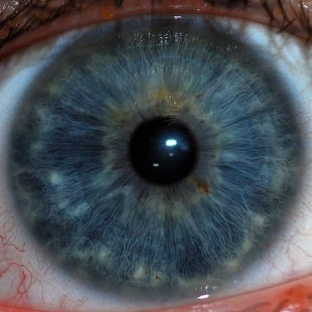 definition-of-dilation