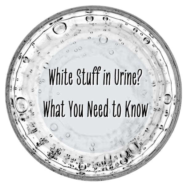 white-stuff-in-urine