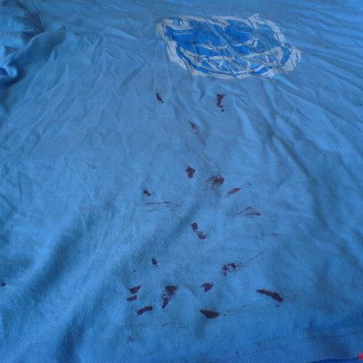 How To Clean Dry Blood Stains From Clothes