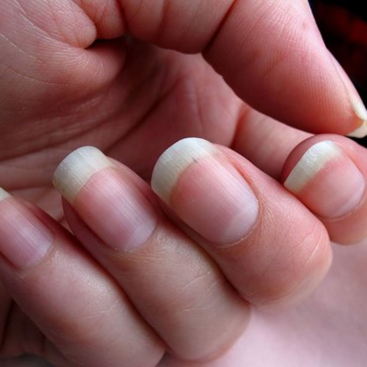 How to quit nail biting - kicking a 17-year-old habit because of COVID-19