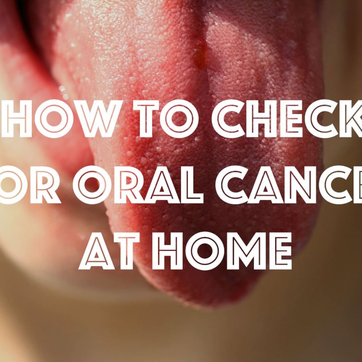 How Check for Mouth Cancer at Home -